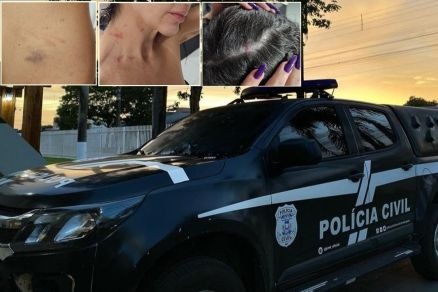 Servidora diz que apanhou de cassetete de mulher de policial em MT